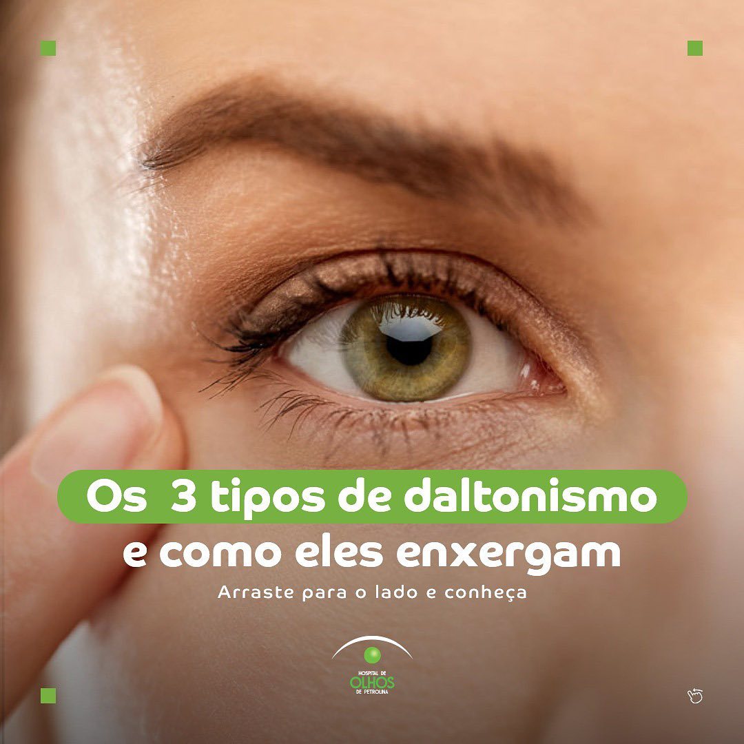 Os 3 tipos de daltonismo e como eles enxergam