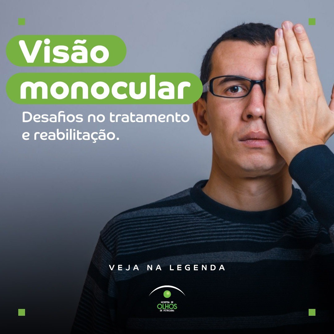 Visão Monocular