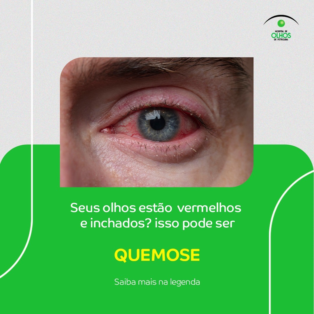 O que é Quemose?