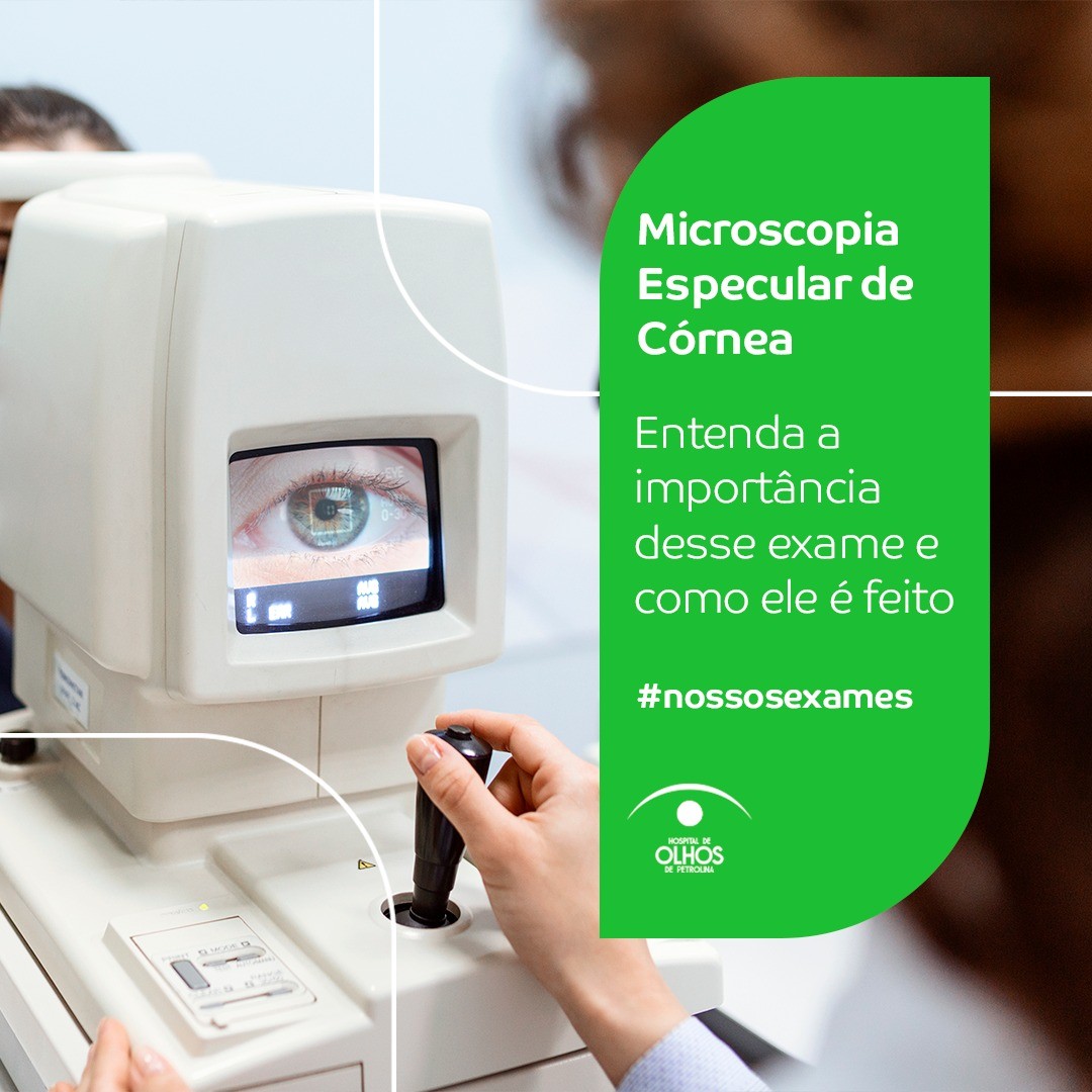 Entenda a Microscopia Especular de Córnea